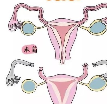 现在在做哈萨克斯坦NGC医院试管热点试管-能有几个？我们来看看分解吧！